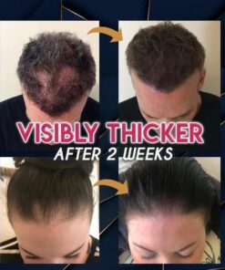 Pure Grow Haarwachstumsessenz