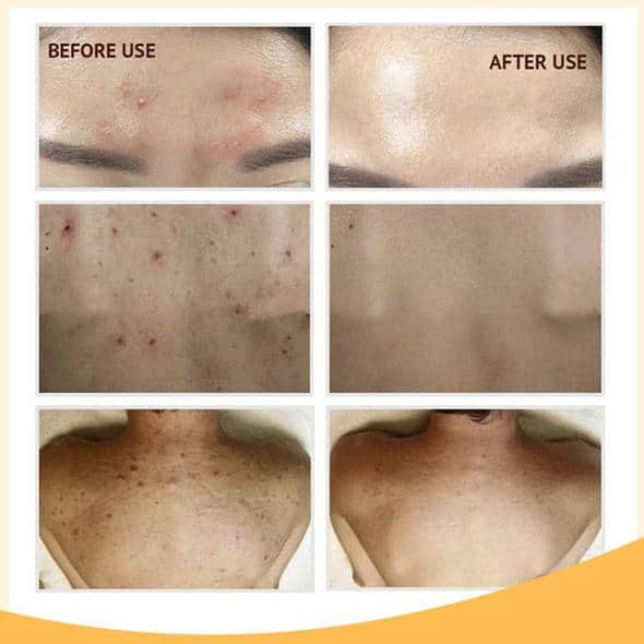 Retinol C+ Aufhellendes Serum-Set - Image 10