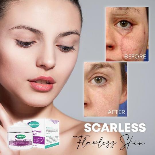 Medease Skin Rebound Creme - Image 2