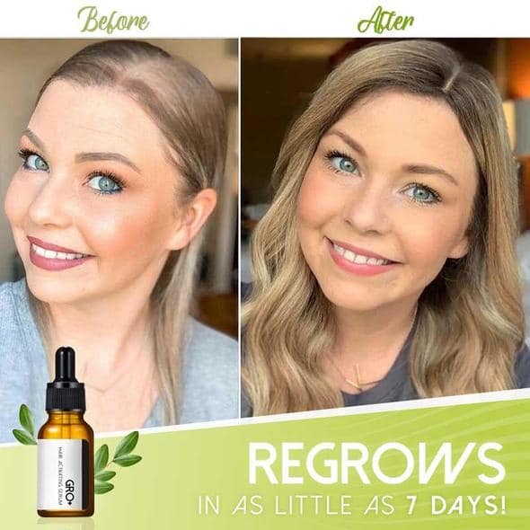 Gro+ Haaraktivierendes Serum - Image 3