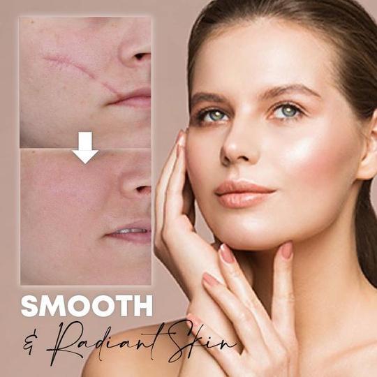 Medease Skin Rebound Creme - Image 3