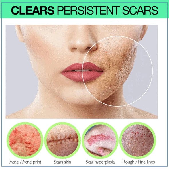 PRO Niacinamid Narbenserum - Image 3