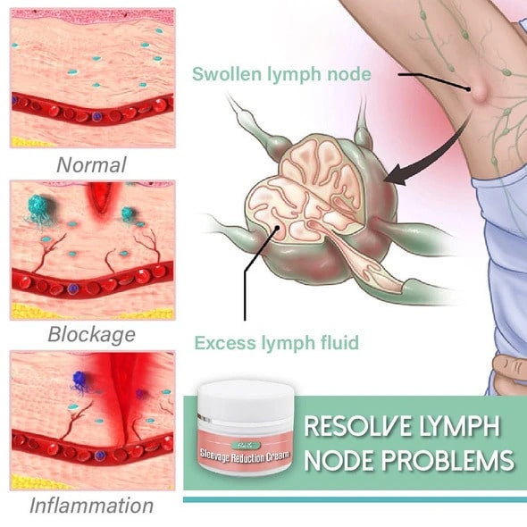 Creme zur Ärmelreduzierung - Image 3