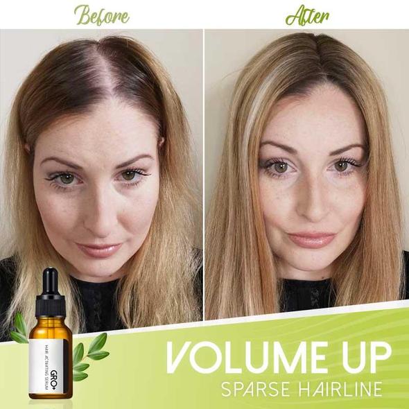 Gro+ Haaraktivierendes Serum - Image 4