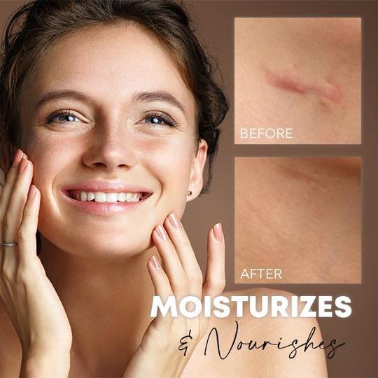 Medease Skin Rebound Creme - Image 4