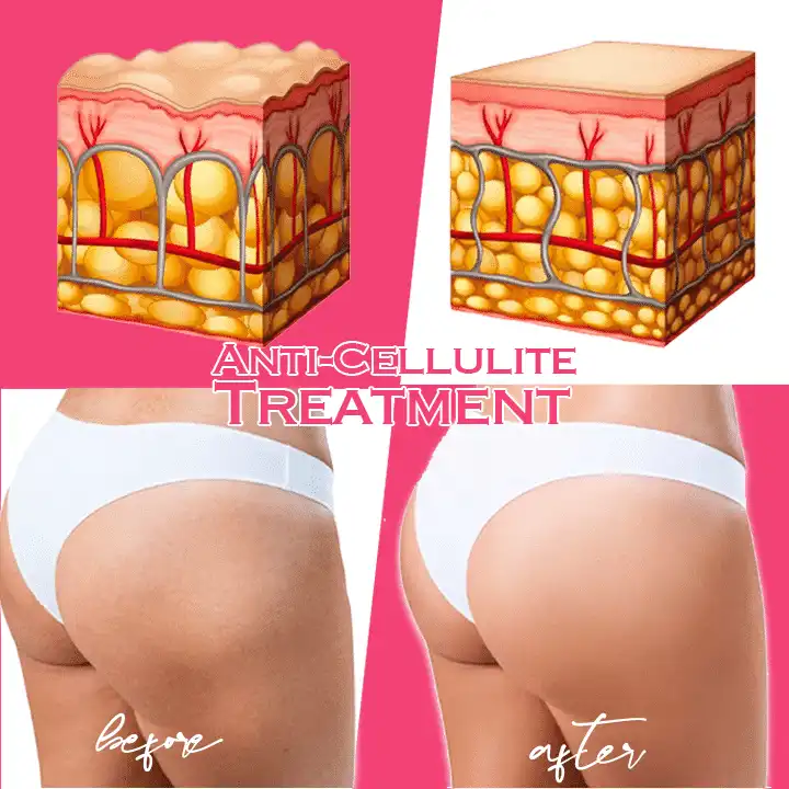 Koffein-Festigkeits- und Tonisierungscreme - Image 4