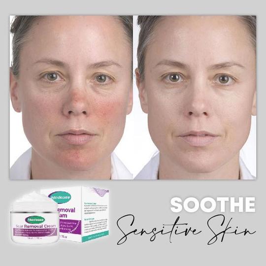 Medease Skin Rebound Creme - Image 6