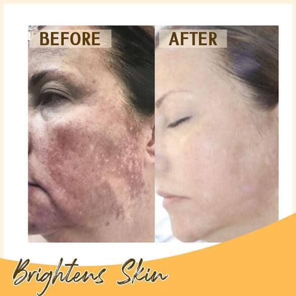 Retinol C+ Aufhellendes Serum-Set - Image 6