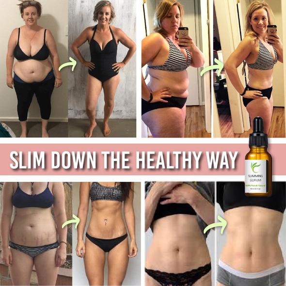 Bauchstraffungsgürtel mit Fettverbrennungsserum - Image 6