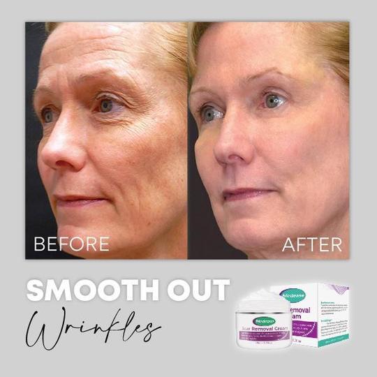 Medease Skin Rebound Creme - Image 7