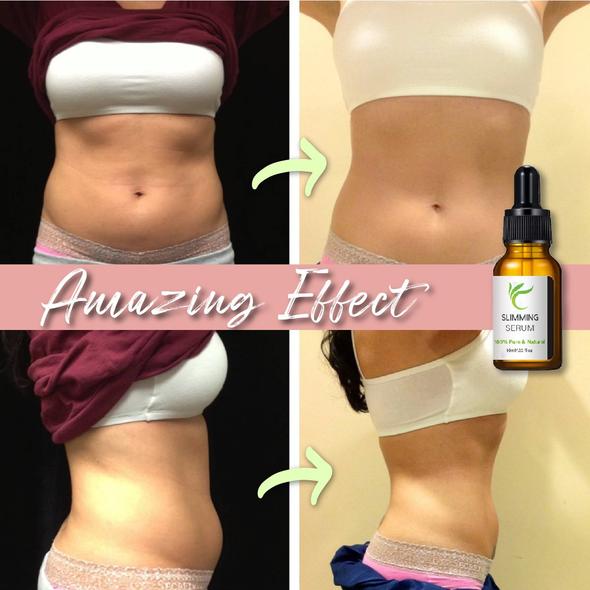 Bauchstraffungsgürtel mit Fettverbrennungsserum - Image 7