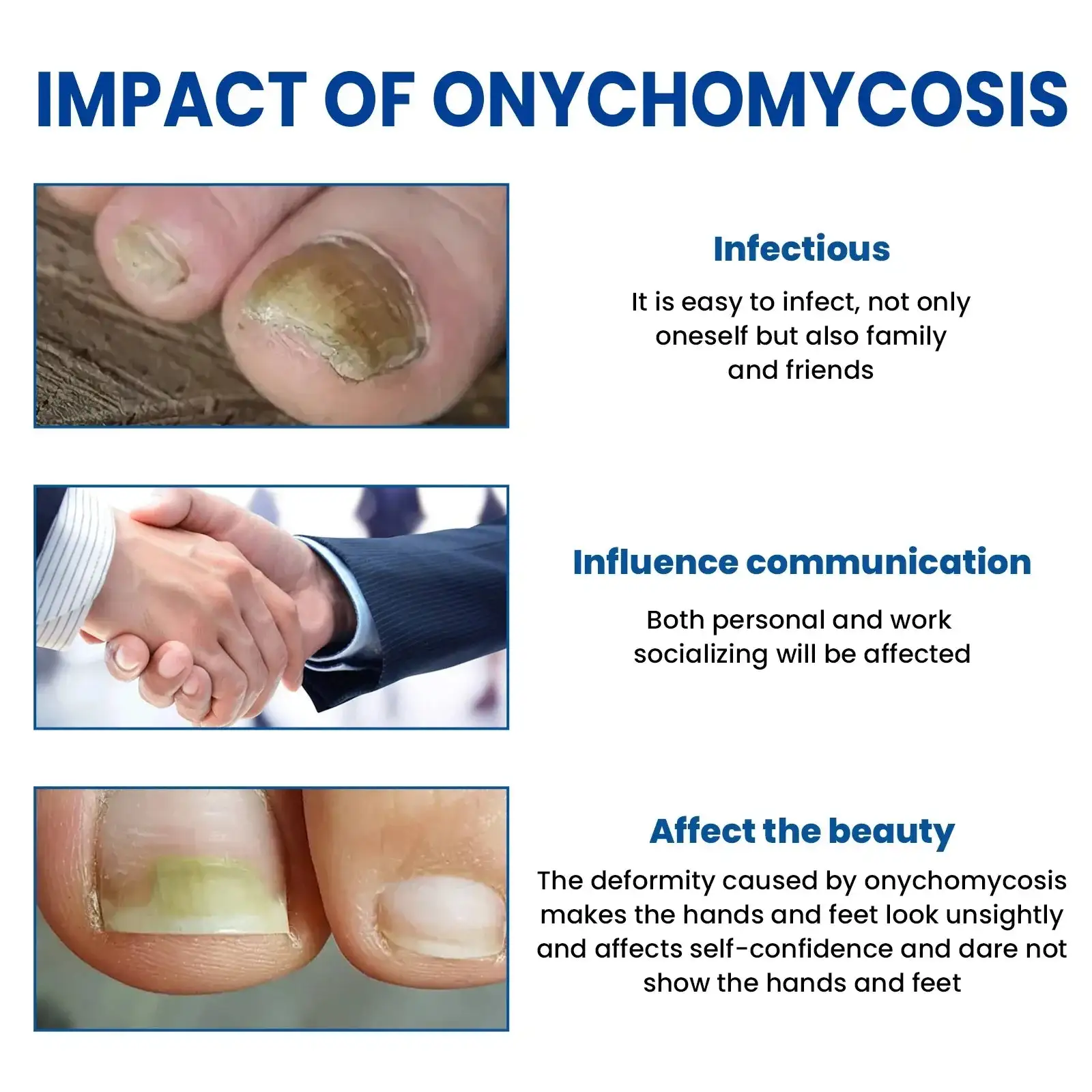 Acezozla® Nagelpilz-Reparaturpflaster - Image 2