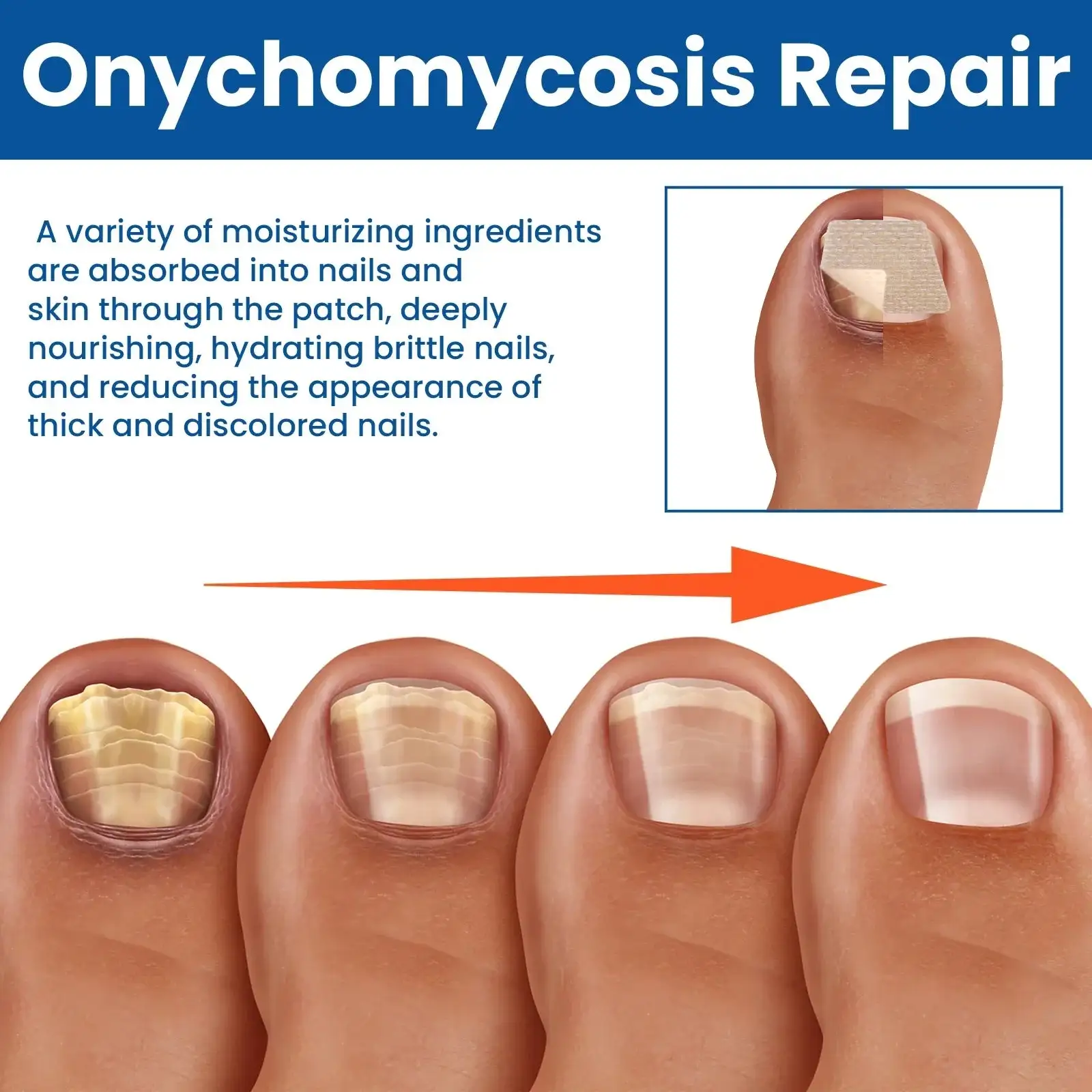 Acezozla® Nagelpilz-Reparaturpflaster - Image 4