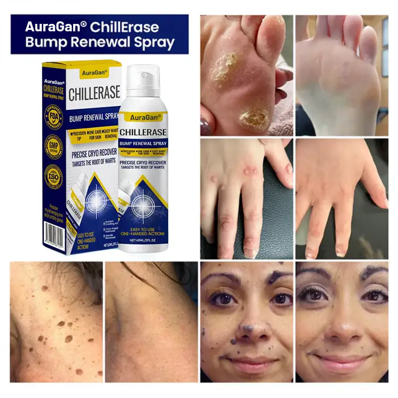 AuraGan® ChillErase Bump Renewal Spray - Image 4