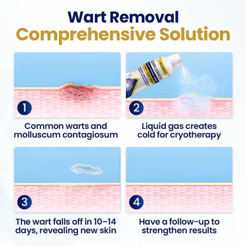 AuraGan® ChillErase Bump Renewal Spray - Image 6