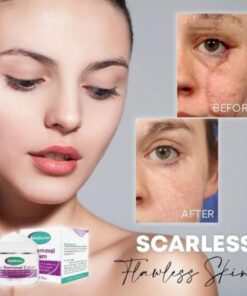 Medease Skin Rebound Creme