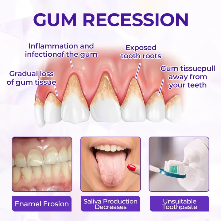 Virexo™ SensiGum Fluorid-Zahnpasta - Image 8