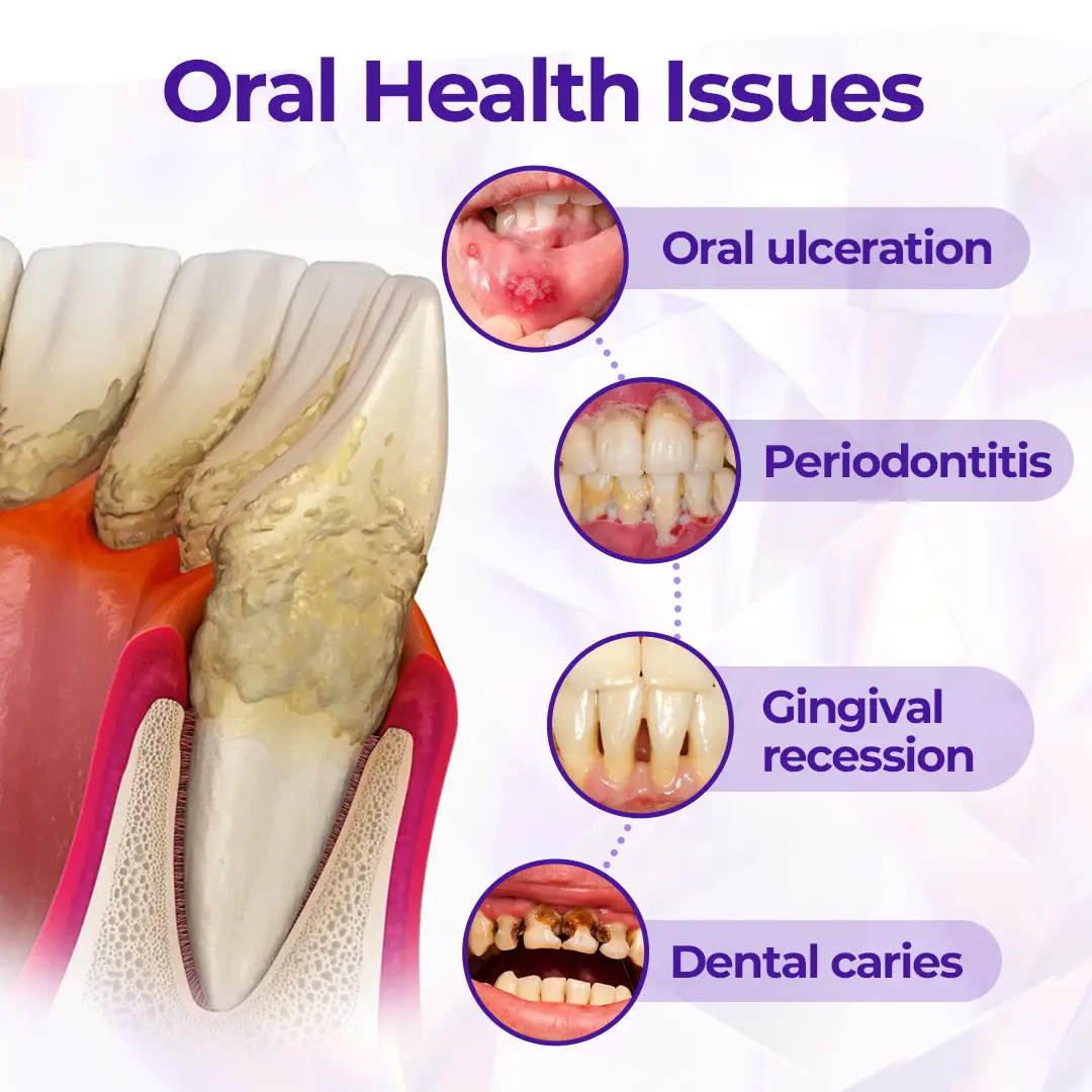 Virexo™ SensiGum Fluorid-Zahnpasta - Image 9